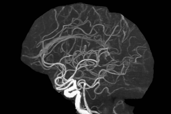 Искусственный интеллект научили выявлять сужение мозговых артерий 1-1.jpg (jpg, 83 Kб)